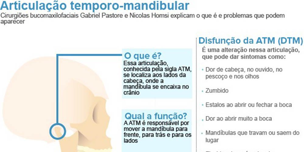 Estalos, zumbido, dor de cabeça e na face são sinais de disfunção na ATM
