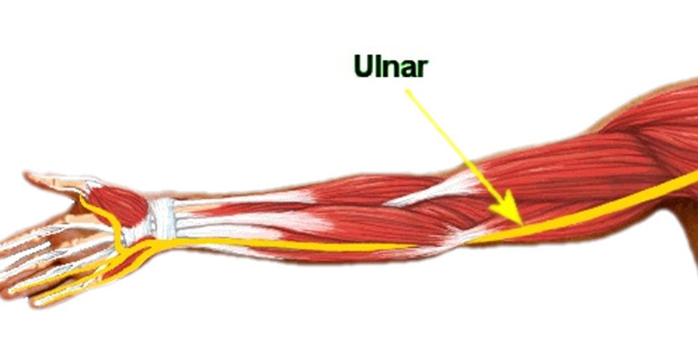 Como a Fisioterapia pode proporcionar alívio da dor do nervo ulnar